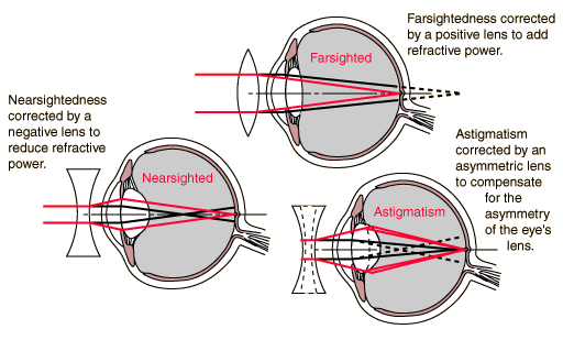 myopia diagram gcse